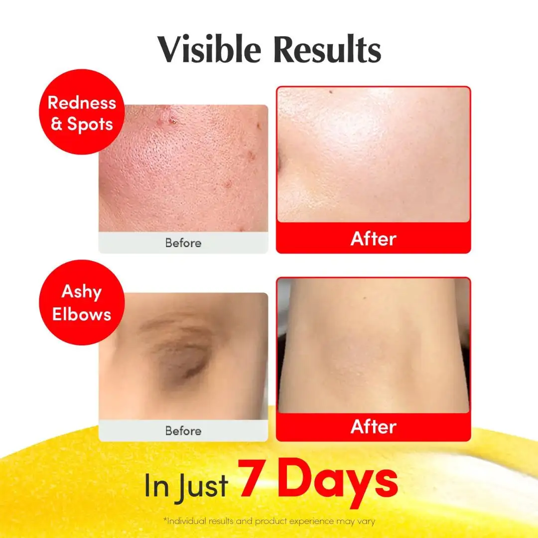  سيروم إيكوال بيري: بديل التفتيح الليزري لتوحيد البشرة