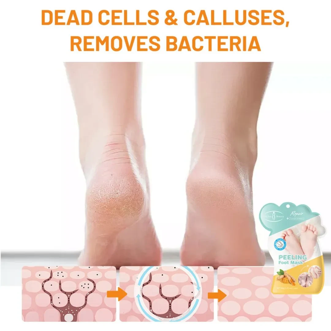 ماسك تقشير القدمين من آيتشون بيوتي بخلاصة الكركم والعسل - 40 غ